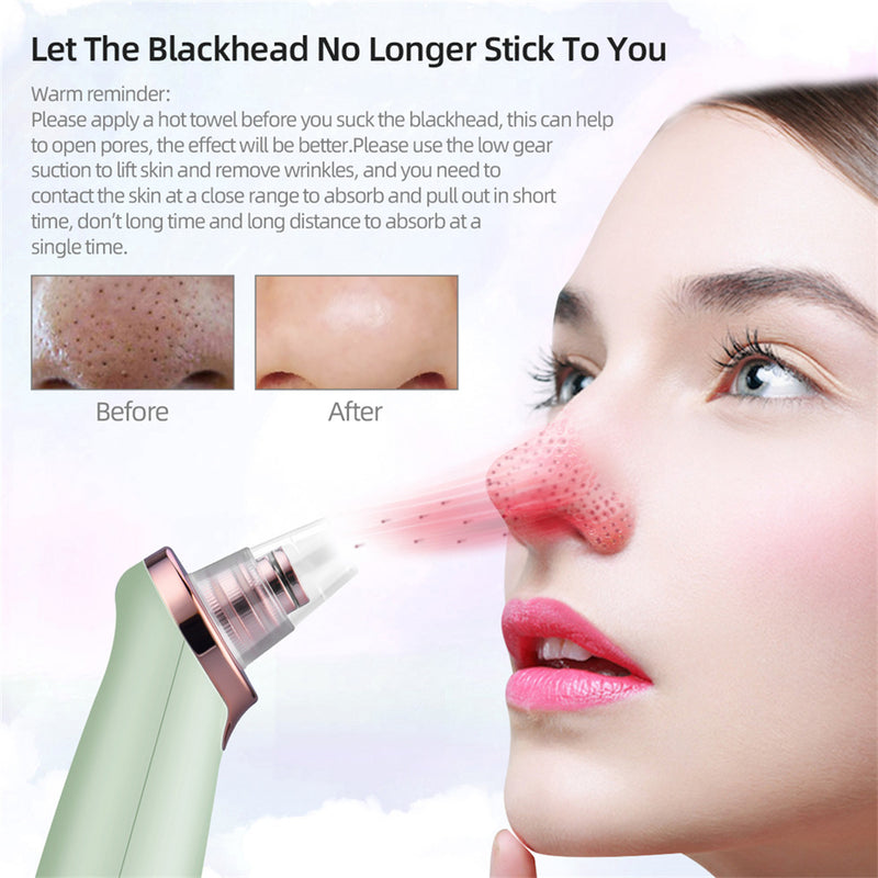 ClearSkin Pro: Electric Pore Cleanser