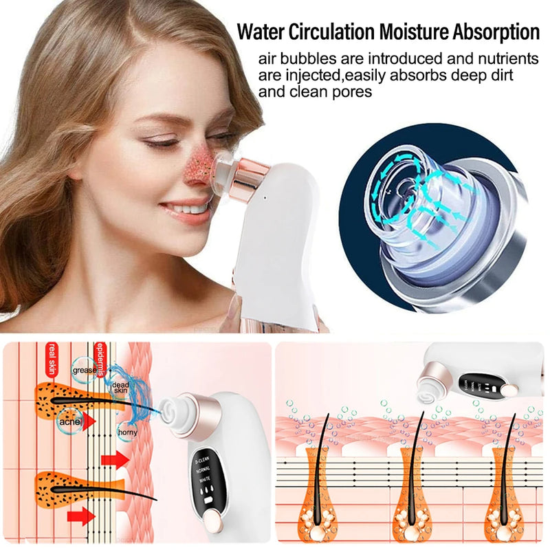STYLPRO Hydro Exfoliator