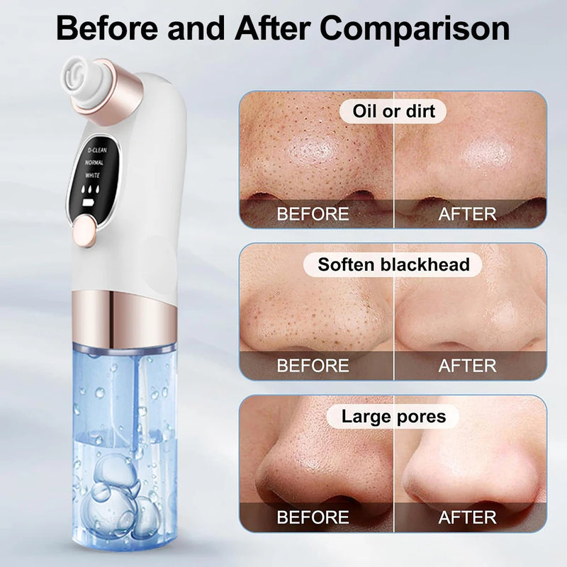 STYLPRO Hydro Exfoliator