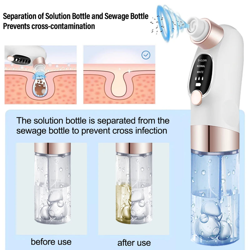 STYLPRO Hydro Exfoliator