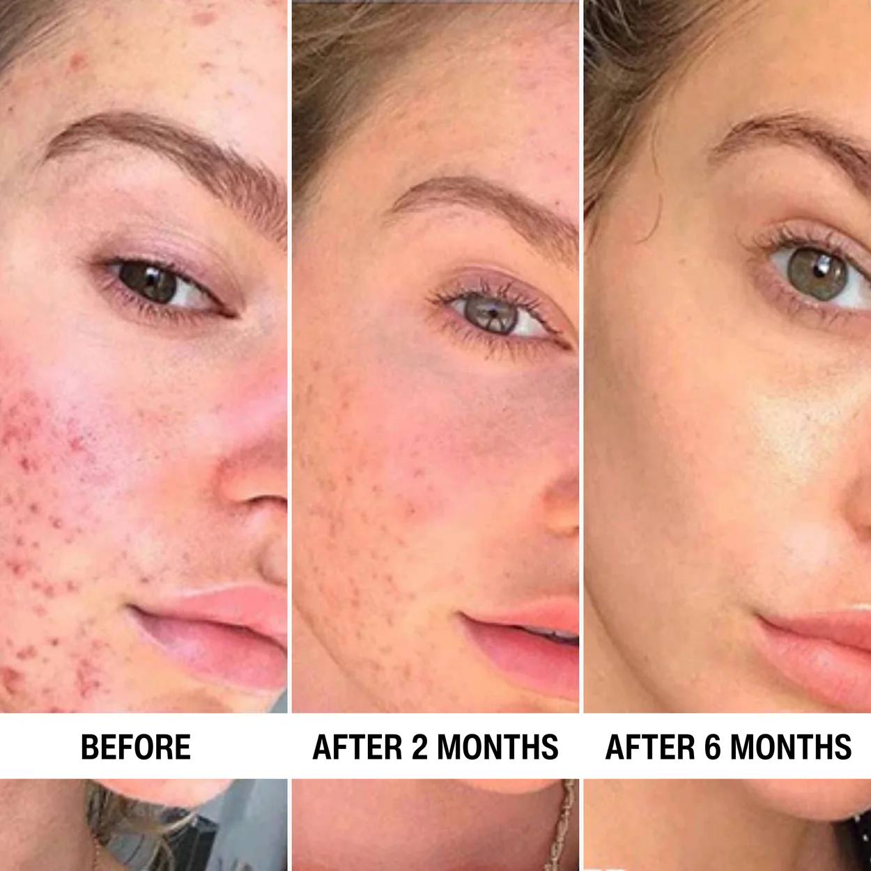 LumiDerma Pro™ — 850nm Near-Infrared LED Therapy Mask