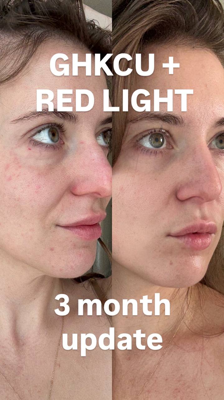 LumiDerma Pro | 850 nm LED Light Therapy Mask