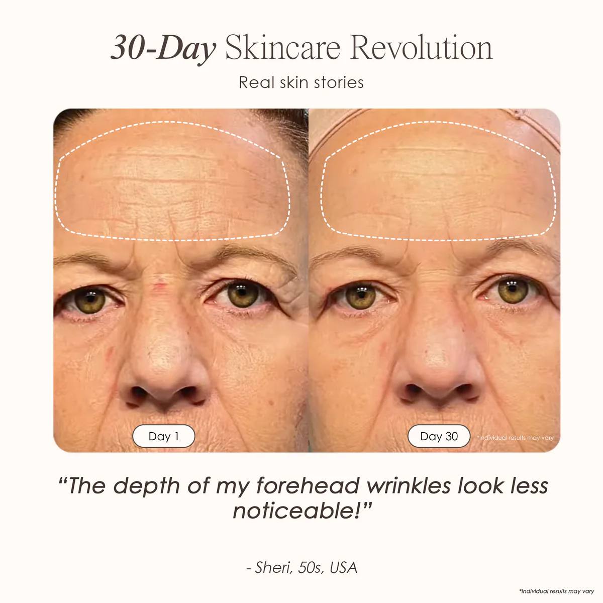 LumiDerma Pro | 850 nm LED Light Therapy Mask